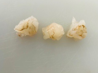Rock Shrimp Tempura - Creamy Spicy Sauce - Step 15